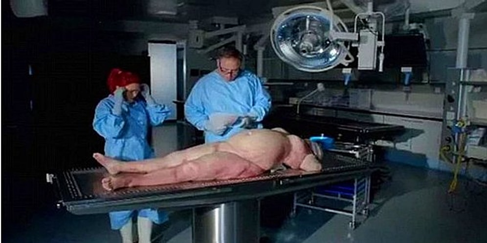 İngiliz Belgeselde Yapılan Otopsi Obezitenin Tam Anlamıyla 'İç Yüzünü' Ortaya Çıkardı