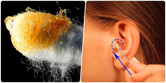 Neden Kulağınıza Asla Pamuklu Kulak Çöpü Sokmamalısınız?