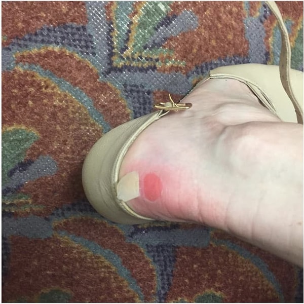 15. Лейкопластырь - лучший друг всех любительниц каблуков!