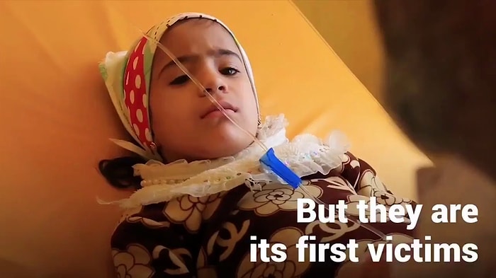 Kıtlığın Eşiğine Gelen Yemen'de Yüz Binlerce Çocuk Ölümle Burun Buruna Yaşıyor!
