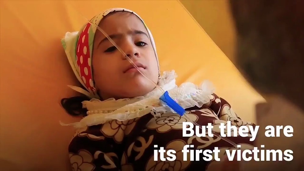 Kıtlığın Eşiğine Gelen Yemen'de Yüz Binlerce Çocuk Ölümle Burun Buruna Yaşıyor!