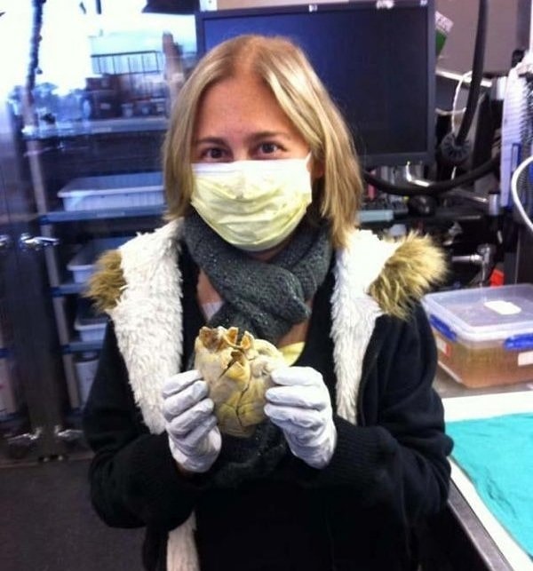 8. Пенни, сильная женщина, победившая рак и сердечную недостаточность, держит в руках свое сердце.