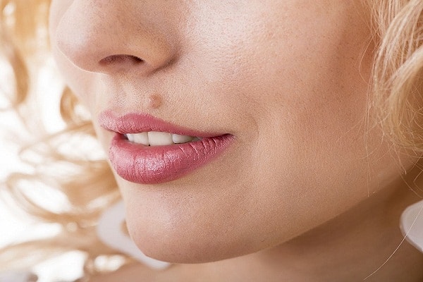 5. Вы родились с какими-нибудь большими родинками?