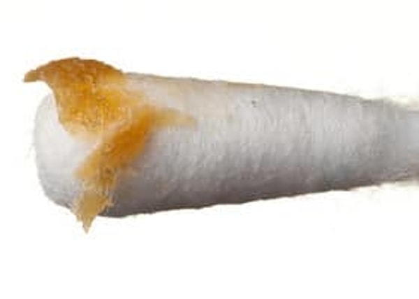 Kulak pisliği