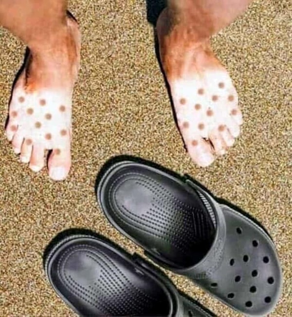 18. Когда летние приколы с загаром всё ещё не отпускают...