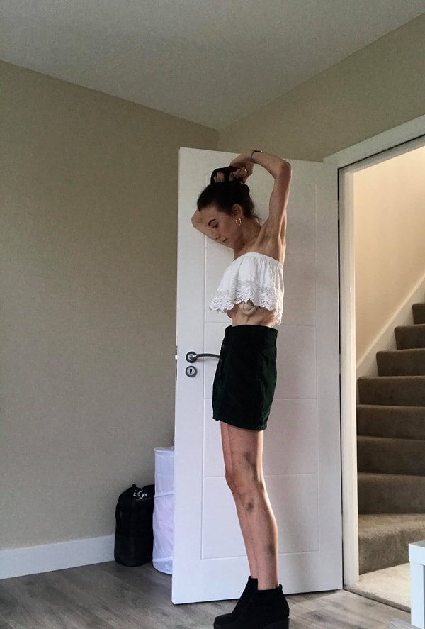 7. Эмили говорит, что близким важно сказать что-то больному человеку, но при этом необходимо «выслушать его и не нападать», говоря, что «болезнь манипулирует тобой», ведь это заставит только выплеснуть гнев на людей, несмотря на то, что их слова идут от сердца.