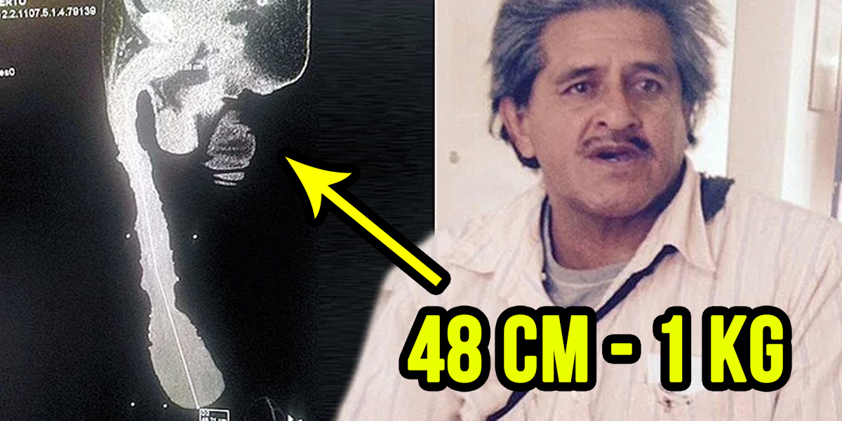 Ormonda yechingan porno qiz