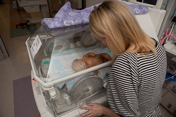 4. Малышку Бренну отправили в отделение интенсивной терапии, поскольку она была неподвижной.