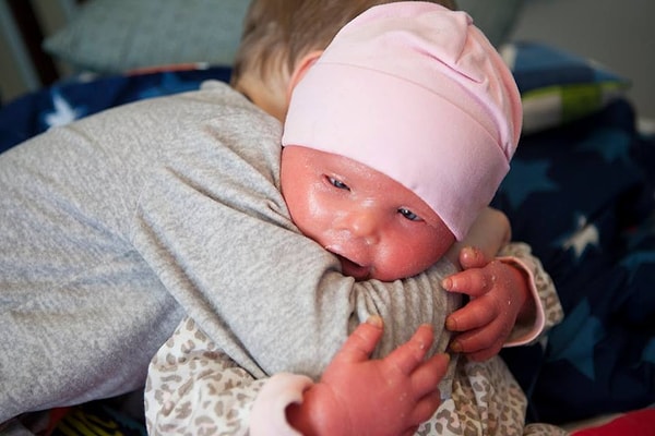 7. Видя, через что проходит ее ребенок, мама Бренны поняла, что малышку ждет сложная жизнь.