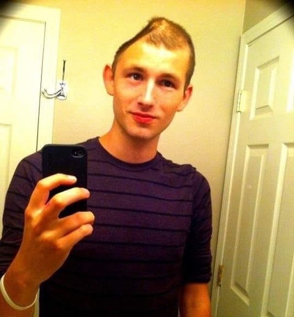 10. Этот парень после серьёзной аварии перенёс несколько операций на черепе и выжил!