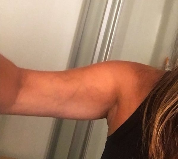 15. Вены на руке девушки в форме сердца ❤️