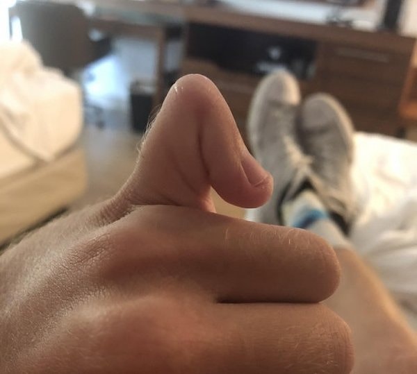 16. "В моём мизинце только 1 сустав"