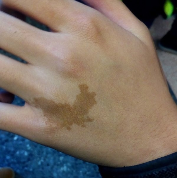 18. "У моего друга из Китая родимое пятно в форме очертаний Китая на карте"