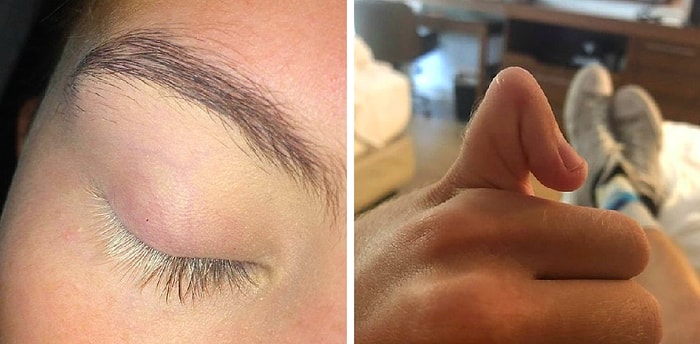 Особенные среди нас: Смельчаки показывают удивительные особенности и способности своего тела