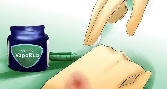 3. Morlukları geçirmede etkili olabilir.