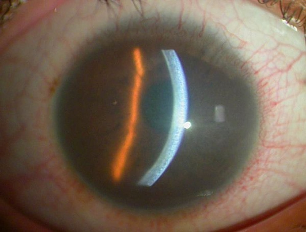 Öğrenince Aynaya Bakmaya Korkacağınız, Vücudunuzla İlgili Bilmediğiniz 10 Ürkütücü Şey