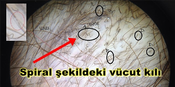 C Vitamini Eksikliğinin Vücudunuzda Nasıl Belirtiler Gösterdiğini Biliyor muydunuz?