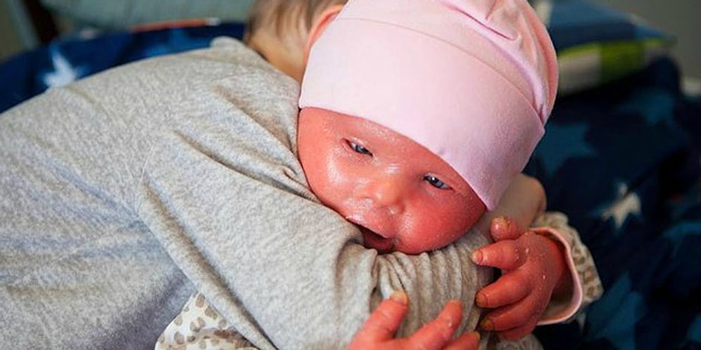 Редкое заболевание не должно отпугивать: история маленькой Бренны