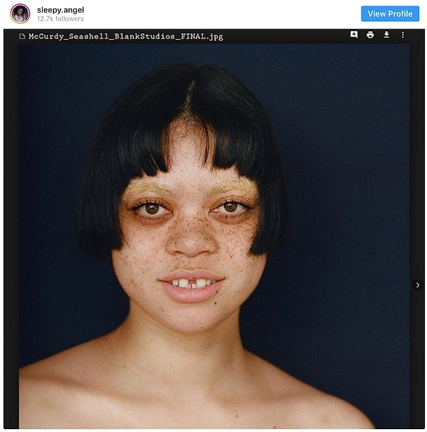 7. Очаровательная щербинка и веснушки Слипи Энгл (Sleepy Angle) - трендовое сочетание.