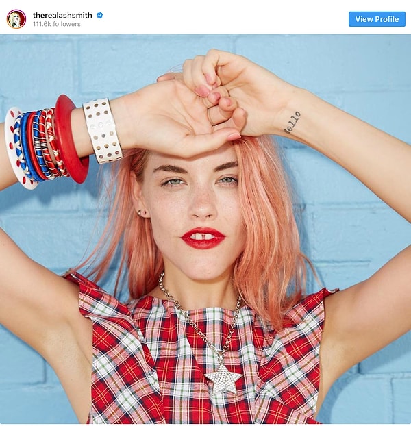 11. Эшли Смит (Ashley Smith) стала всемирно известной не вопреки, а благодаря своей щербинке.