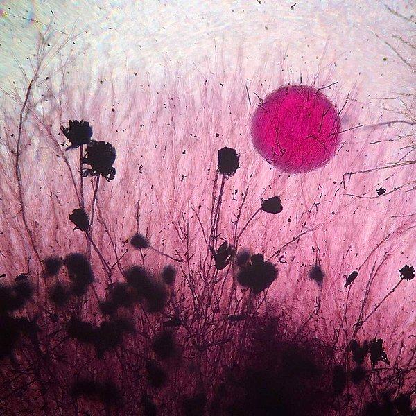 23. "Gün batımı ve çiçekler"i andırsa da,  aslında mikroskop altında bir küf mantarı kolonisine bakıyorsunuz.
