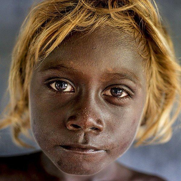16. Solomon Adaları'ndaki yerliler zamanla sarışın olmalarını sağlayan özel bir gene sahip olmuşlar.