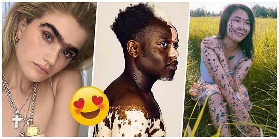 Güzellik Normallikle Sınırlı Değildir! Farklılıklarıyla Adeta Göz Kamaştıran 20 Kişi