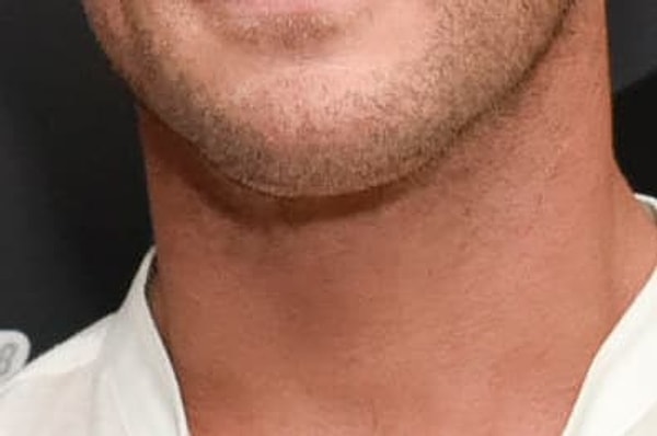 9. Какому из этих красавчиков принадлежит данный подбородок?