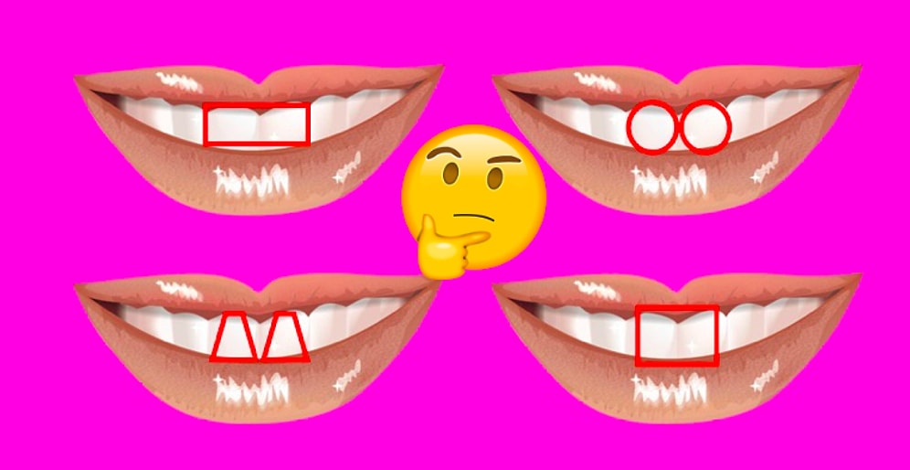 Тест: Раскусим вас по форме верхних резцов, определив, эгоист ли вы