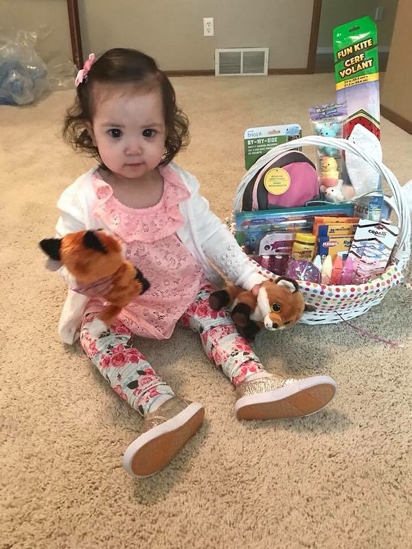 Милани также страдает глаукомой...