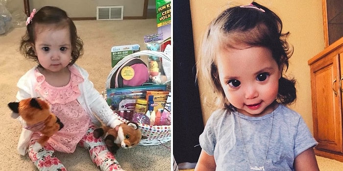 Малышка с большими красивыми глазами, причиной которых стало редкое генетическое отклонение