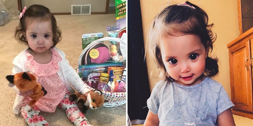 Малышка с большими красивыми глазами, причиной которых стало редкое генетическое отклонение