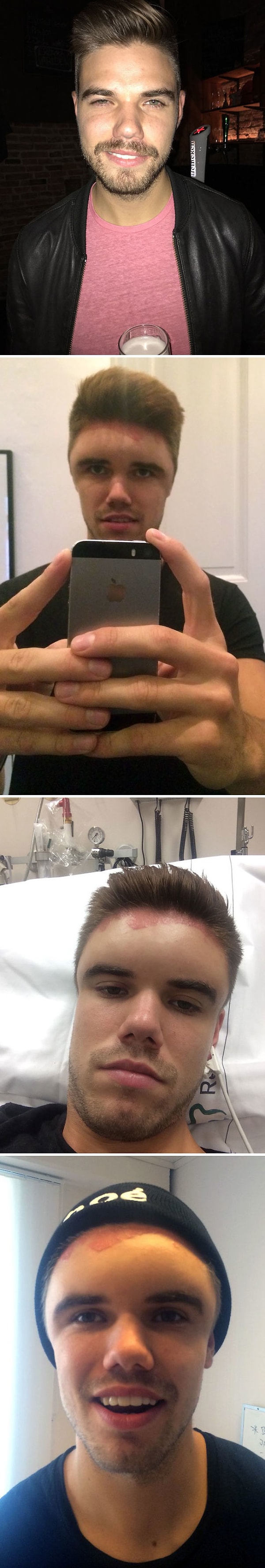 8. "Мой однокурсник покрасил волосы и только потом узнал, что у него аллергия на краску"