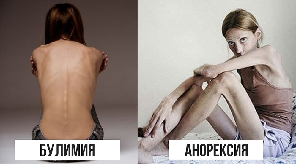 Разница между вещами, с которыми мы сталкиваемся каждый день, но все еще путаем