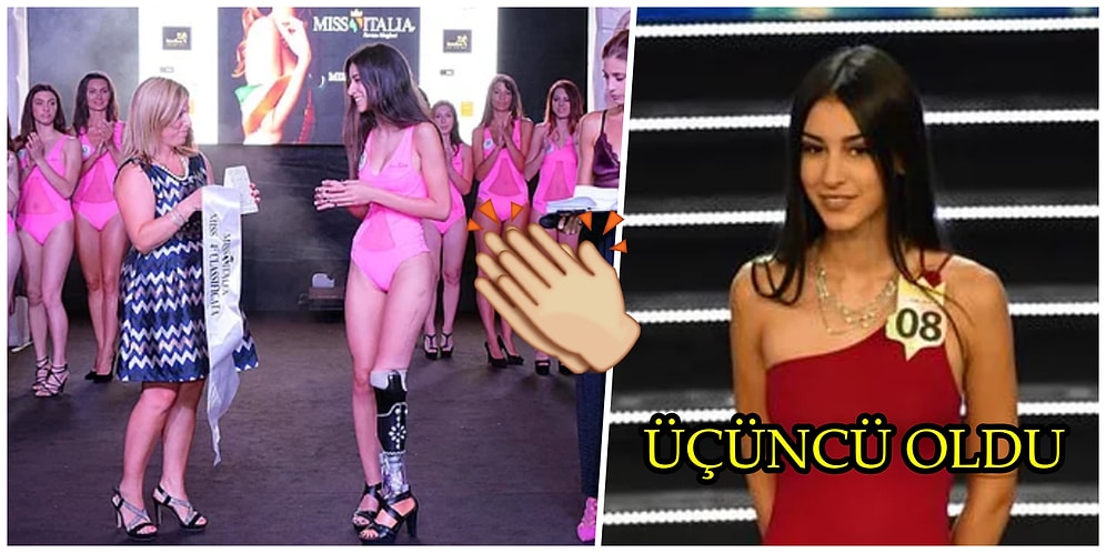 Protez İle Yarışan İlk Yarışmacıydı! Kazada Bacağını Kaybeden Model Güzellik Yarışmasında Üçüncü Oldu