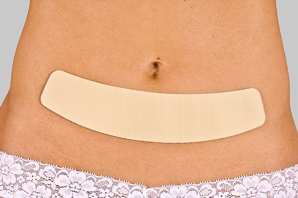 Миф 7: После операции на теле остается ужасный грубый рубец