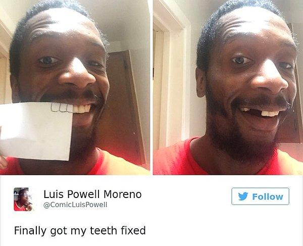 16. "Sonunda dişlerimi yaptırdım."