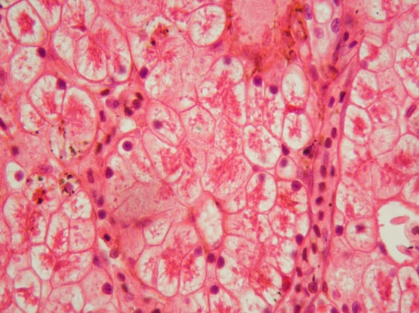 10. Что думаете о своих кровяных клетках?