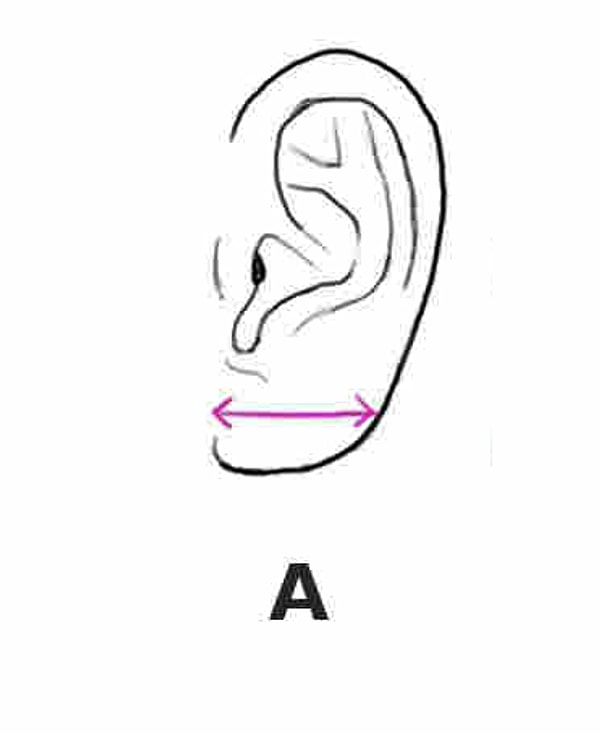 Мочки ушей большие и толстые: