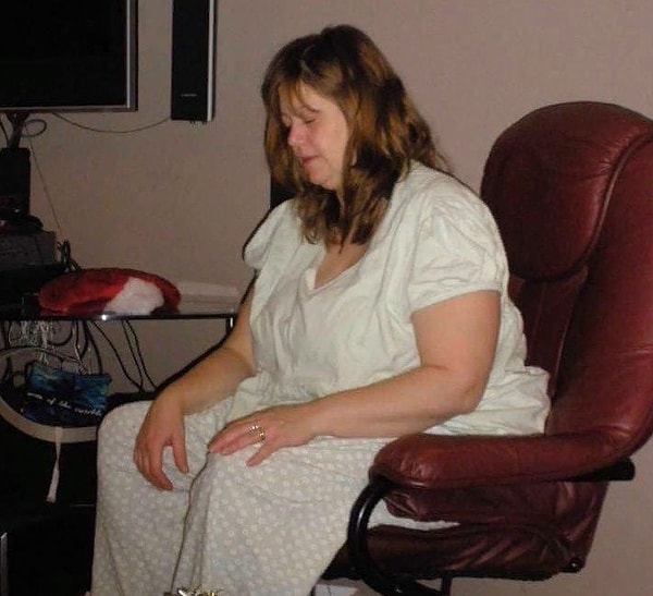 3. Женщина страдала от хронической усталости. У нее настолько немели руки, что Лия не могла самостоятельно помыть голову.