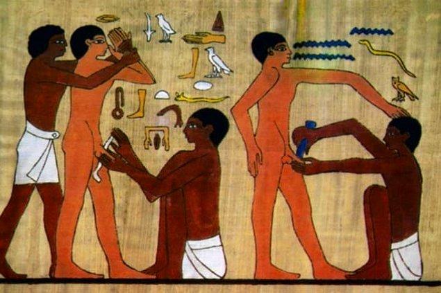 4. Sünnet birçok antik toplum için oldukça olağan dışı olsa da, Mısır'da var olan bir gelenekti.