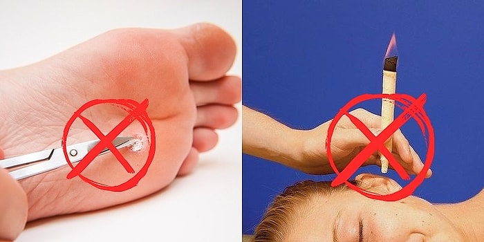 Kesinlikle Uygulamamanız Gereken, Sağlığınızı Tehlikeye Sokabilecek Evde Tedavi Yöntemleri