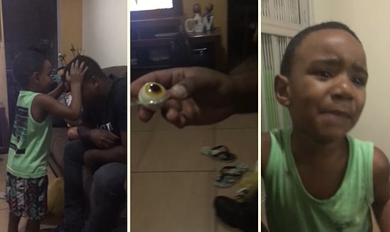 Ufacık Çocuğa Göz Çıkma Şakası Yapan Vicdansızlar!