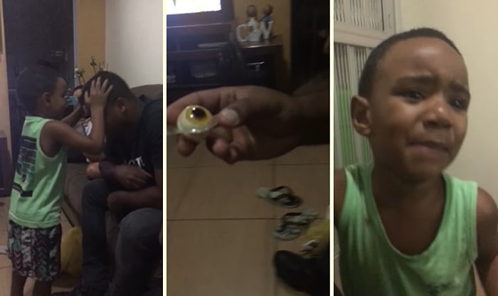 Ufacık Çocuğa Göz Çıkma Şakası Yapan Vicdansızlar!