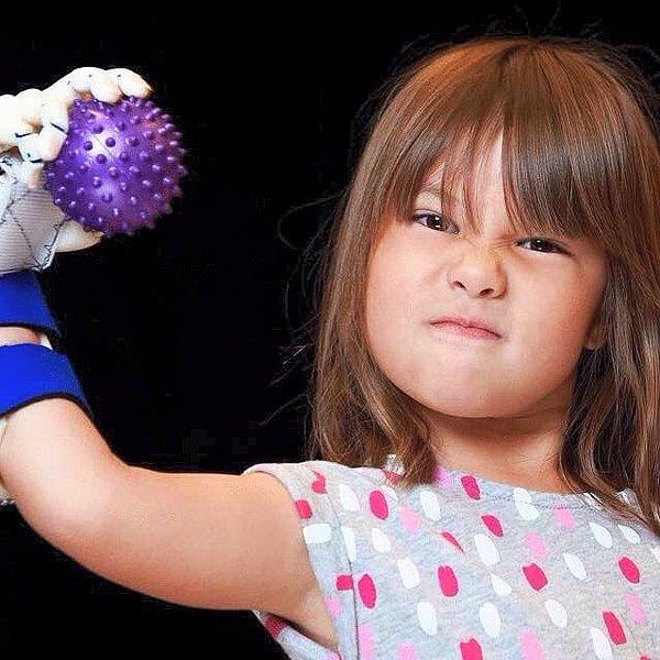 Spor aşığı ufaklık bu küçük eksikliğin onu durdurmasına izin vermeyecekti elbette! Hailey 4 yaşındayken annesi Nevada Üniversitesinden bir robotik el desteği istedi.