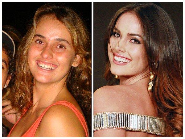 2012 Miss Universe ikincisi Irene Esser'in doktoru Osmel Sousa tebrikleri kabul ederken, Venezuela'nın estetik operasyon çılgınlığı iyice ortaya çıkmış oldu.