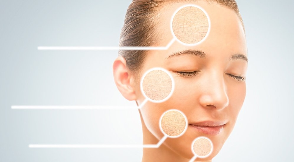 Раз и навсегда научим распознавать тип кожи и подбирать правильные средства для ухода за ней