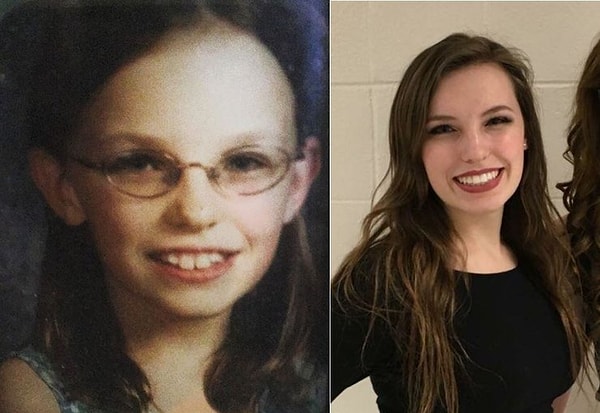 17. "11 и 20. Надела контактные линзы, сделала коррекцию бровей и исправила зубы с помощью брекетов"