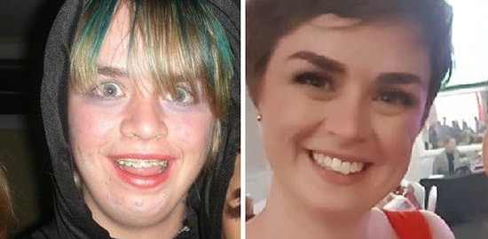 Из «гадкого утенка» в лебедя: они смогли утереть всем нос