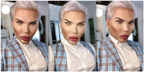 Geçirdikleri Estetik Ameliyatlara Servet Harcayarak Tüm Dünyanın Gündemine Oturan İnsanlar